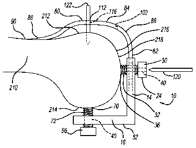 A single figure which represents the drawing illustrating the invention.